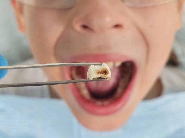 Best Orthodontic Emergency Dentist in Moody, AL